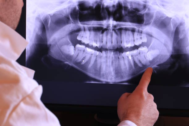 Best Emergency Dentist Near Me  in Pocono Woodland Lakes, PA