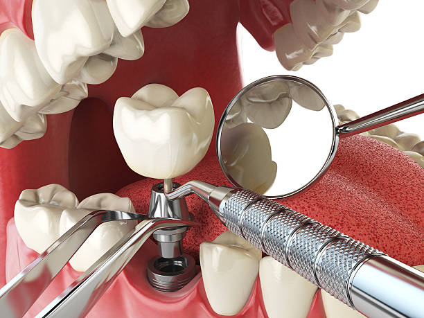 Best Broken Tooth Emergency  in Pocono Woodland Lakes, PA